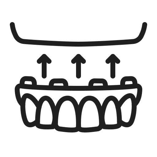 All-on-4 Implants - Full Arch Restoration