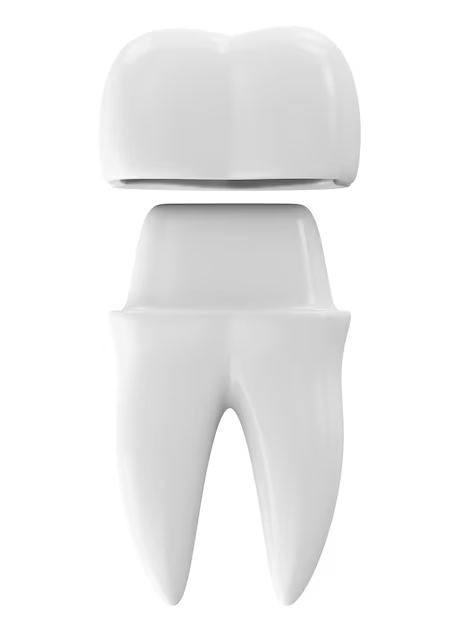 What are Dental Crowns?